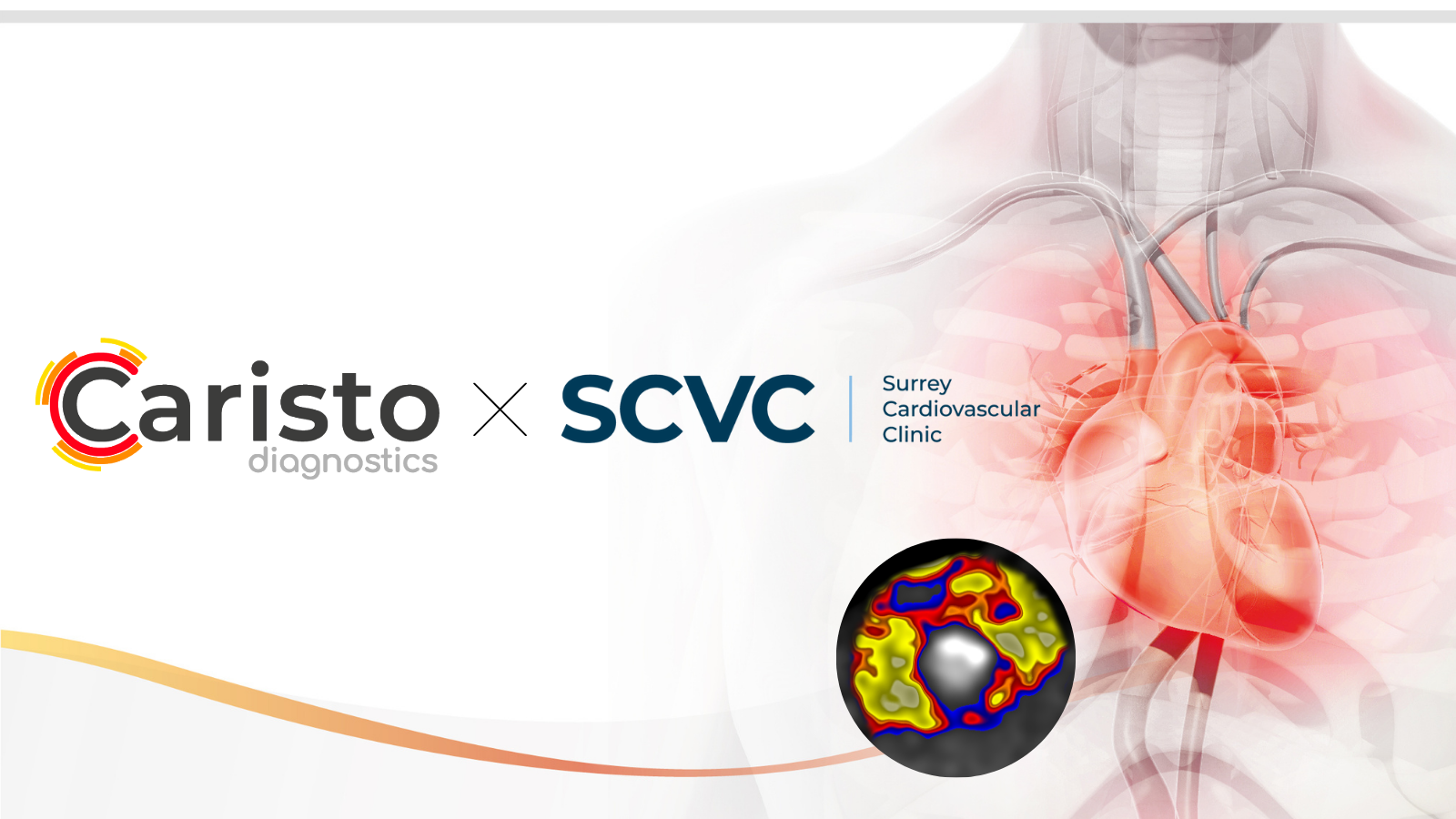 Caristo and SCVC logo